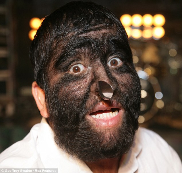 Cán thìa đã nằm gọn trong mũi của 