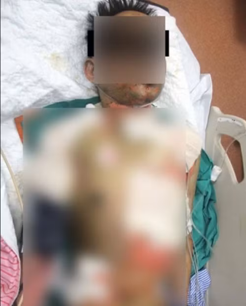 Nam sinh viên đang được điều trị ở bệnh viện. Ảnh: 8world News.