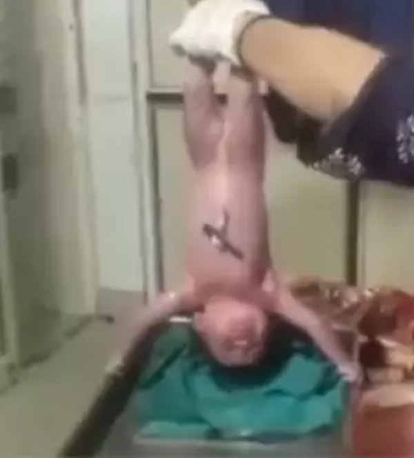 Nhấc ngược bé sơ sinh là đúng hay sai? Ảnh: X (Twitter).