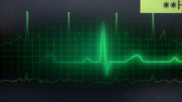 Những bệnh nhân được cứu sống sau khi tim ngừng đập đã "nhìn thấy" những điều khác nhau. Ảnh: NBC News. Những bệnh nhân được cứu sống sau khi tim ngừng đập đã "nhìn thấy" những điều khác nhau. Ảnh: NBC News.