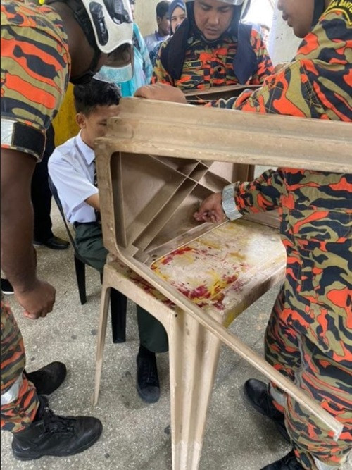 Sau gần nửa tiếng thì nam sinh đã rút được ngón tay ra khỏi mặt bàn. Ảnh: Sin Chew Daily. Sau gần nửa tiếng thì nam sinh đã rút được ngón tay ra khỏi mặt bàn. Ảnh: Sin Chew Daily.