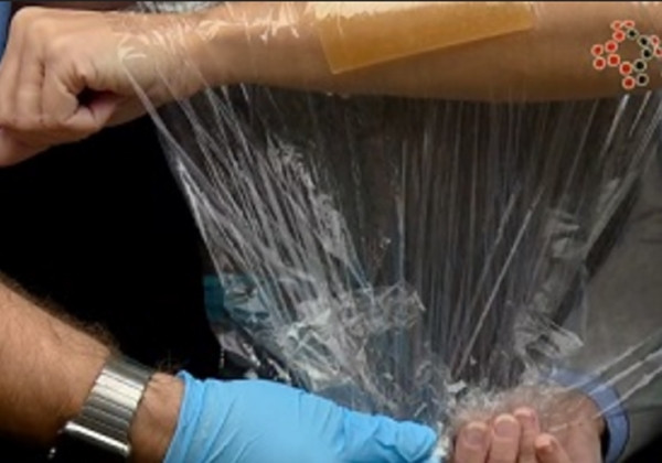 Dùng màng co chống nhiễm trùng vết bỏng trong hỏa hoạn. Ảnh: Profaw.