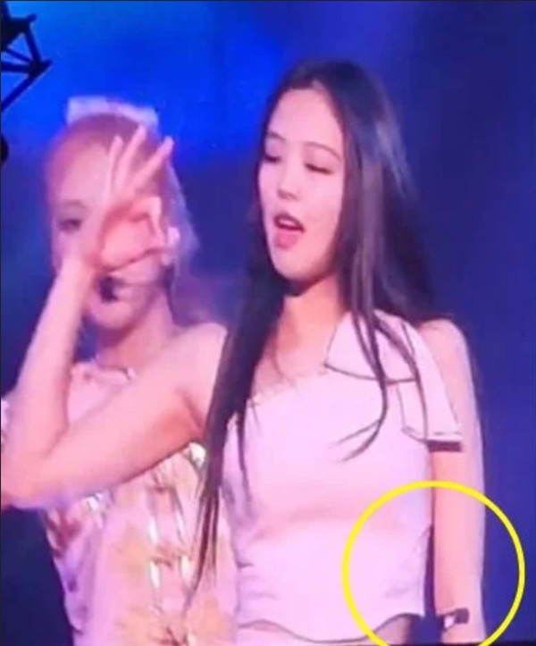 Có vẻ Jennie đã được truyền dịch trước buổi diễn. Ảnh: Twitter. Có vẻ Jennie đã được truyền dịch trước buổi diễn. Ảnh: Twitter.