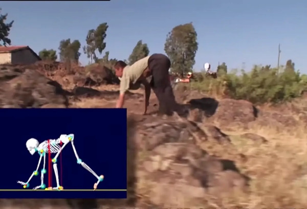 Hệ thống xương của gia đình này có sự khác biệt? Ảnh: NY Post.