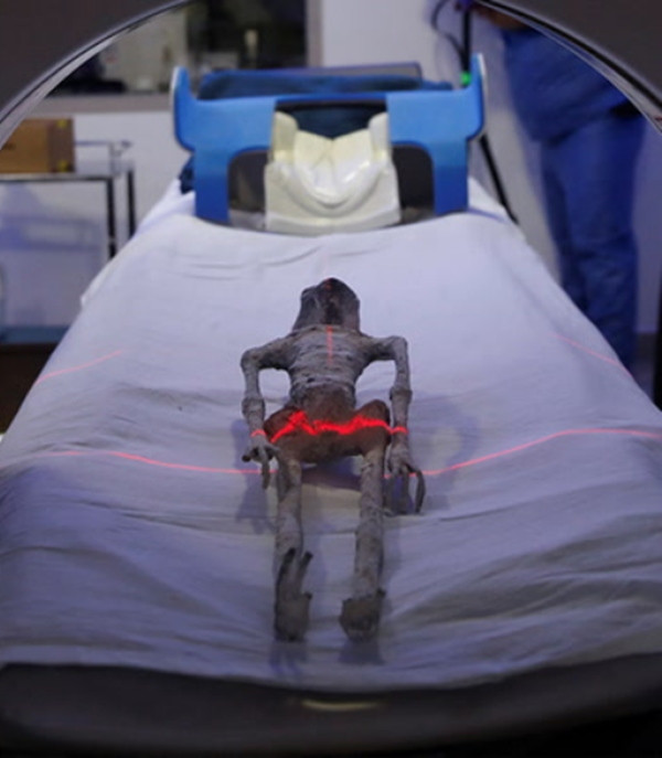 "Người ngoài hành tinh" đang được chụp để kiểm tra. Ảnh: The Independent. "Người ngoài hành tinh" đang được chụp để kiểm tra. Ảnh: The Independent.