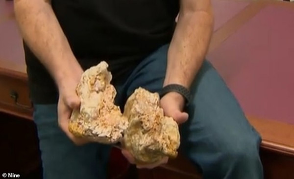 Bên trong cục đất đá là vàng. Ảnh: 9News.