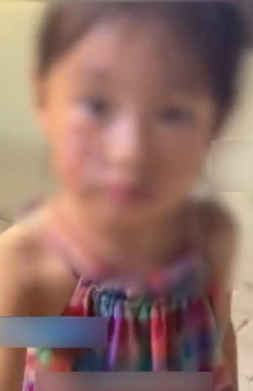 Bé gái bị thương, chảy máu trên mặt. Ảnh: Weibo.