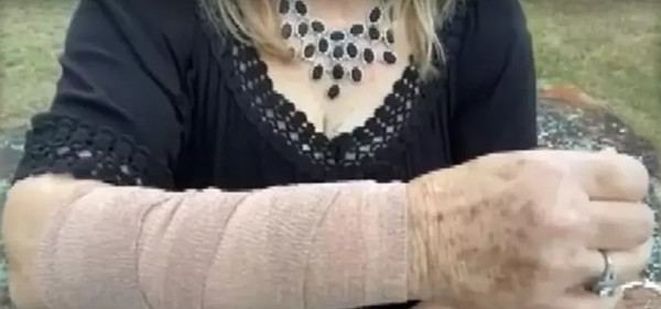 Hậu quả của vụ việc bị cả rắn lẫn diều hâu tấn công. Ảnh: Click2Houston.