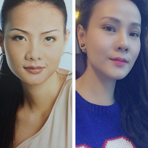 Dương Yến Ngọc gây bất ngờ khi thừa nhận sửa mũi ảnh 1