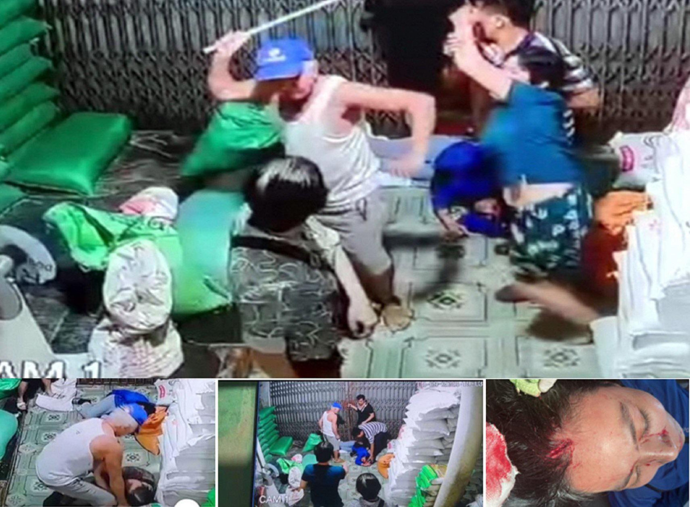 Con dâu nhập viện nghi bị bố chồng 81 tuổi đánh ảnh 1 Con dâu nhập viện nghi bị bố chồng 81 tuổi đánh ảnh 1