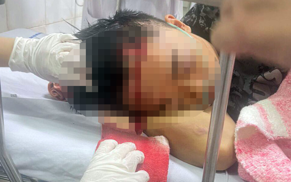 Một thanh niên bị thương trong vụ hỗn chiến. Một thanh niên bị thương trong vụ hỗn chiến.