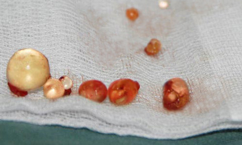 Hãi hùng chuyện quý ông gãy 'súng' vì nghịch dại ảnh 1