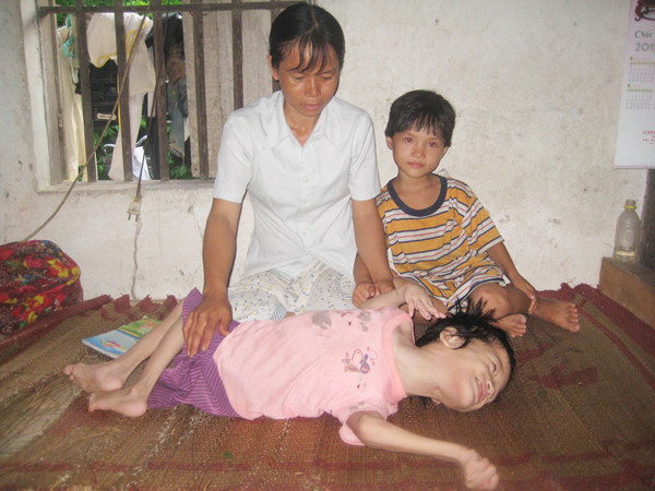 Chị Hương bên người con tật nguyền. Ảnh: D.Ng
