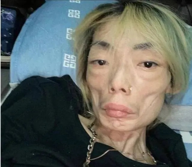 Hình ảnh gầy gò của Ngũ Trí Hằng từng khiến nhiều người sợ hãi. Hình ảnh gầy gò của Ngũ Trí Hằng từng khiến nhiều người sợ hãi.