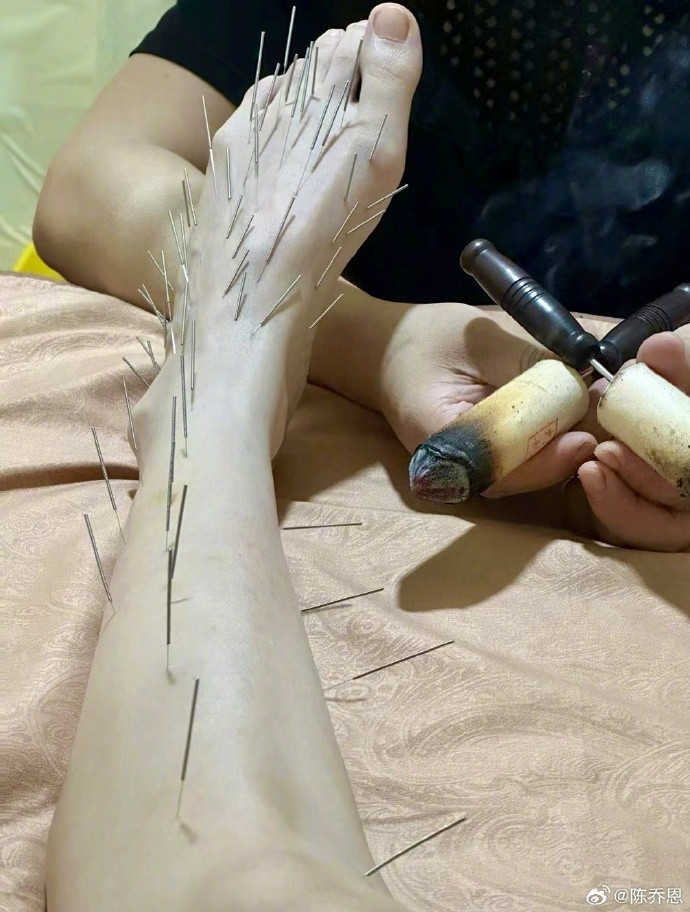 Nữ diễn viên cho biết quá trình điều trị rất đau đớn.