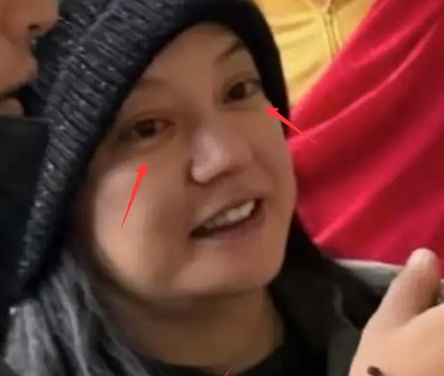 Gương mặt mộc nhiều nếp nhăn của Triệu Vy gây sốc.