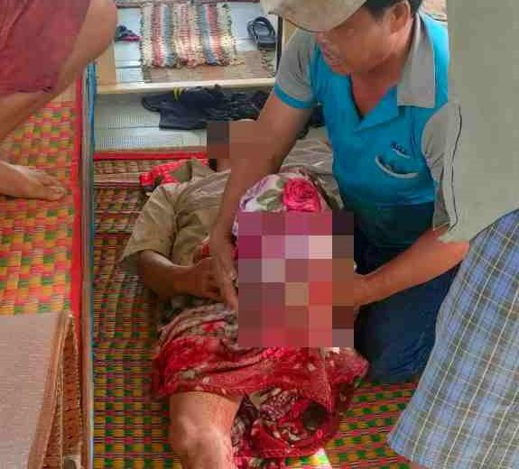 Nạn nhân gặp tai nạn trên biển. Nạn nhân gặp tai nạn trên biển.