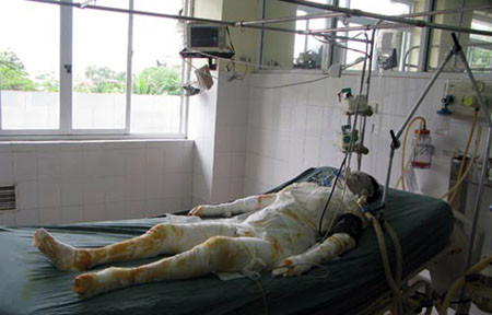 Nạn nhân đang cấp cứu tại bệnh viện. Nạn nhân đang cấp cứu tại bệnh viện