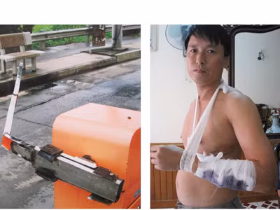 Nạn nhân Thịnh và barie bị đâm hư hỏng
