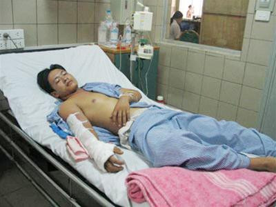 Bệnh nhân bị rắn cắn điều trị tại Trung tâm Chống độc, Bệnh viện Bạch Mai