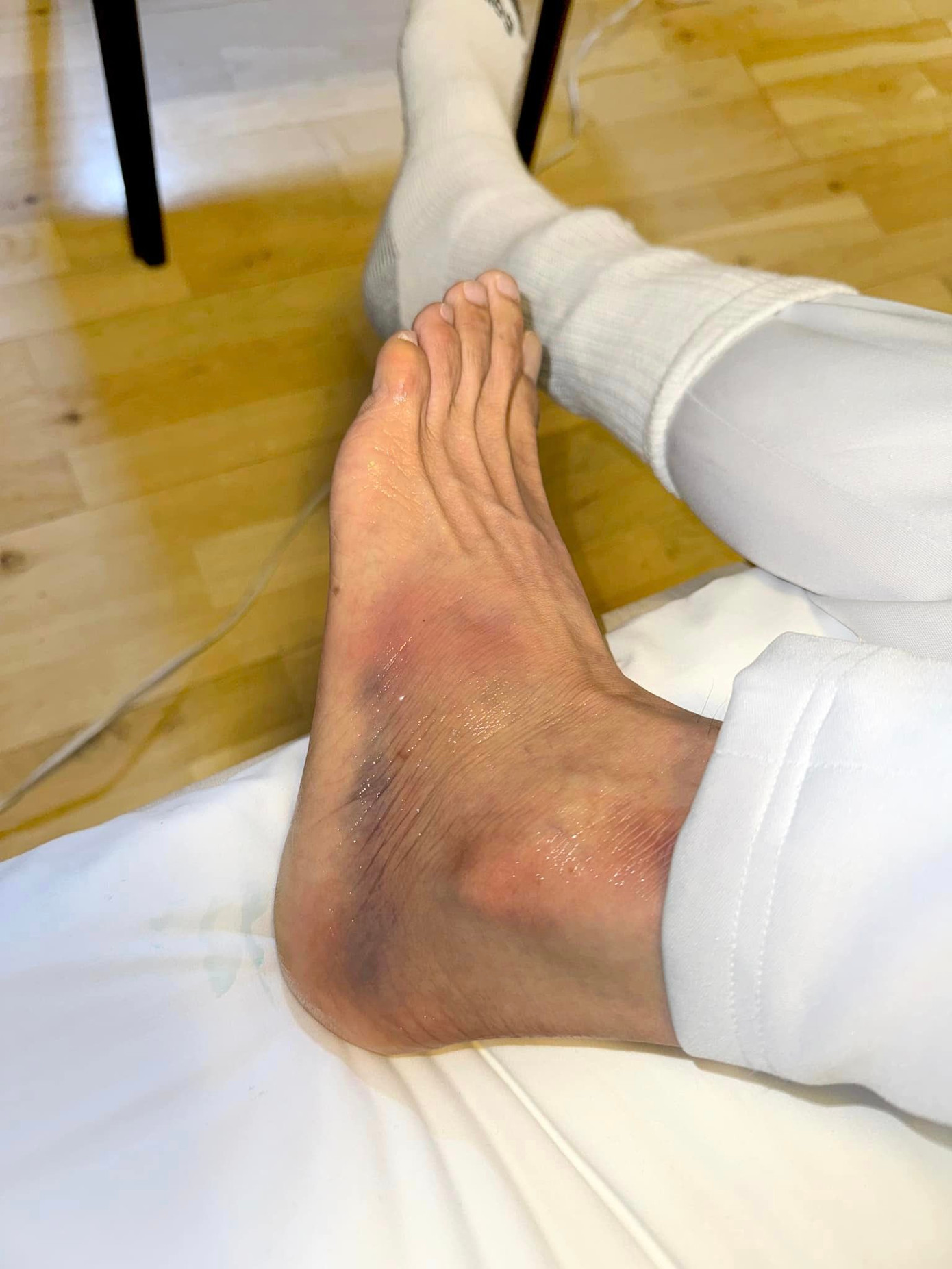 Đan Trường bị ngã cầu thang, trễ chuyến bay và thất lạc hành lý trong chuyến lưu diễn ở nước ngoài.