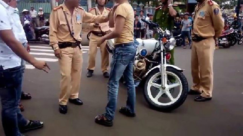 Một thanh niên phân trần về vết thương ở tay. Một thanh niên phân trần về vết thương ở tay