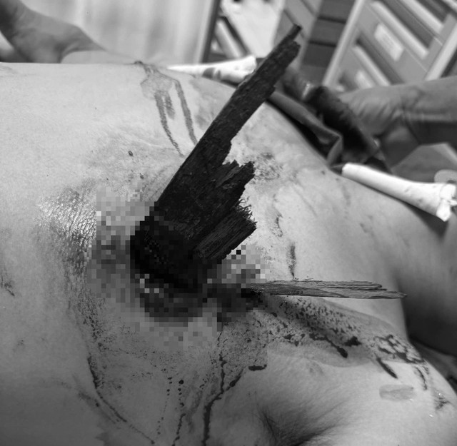 Bệnh nhân được đưa đến bệnh viện trong tình trạng nguy kịch.