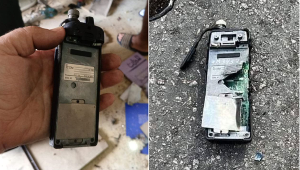 Hình ảnh một bộ đàm phát nổ ở Li-băng được đưa lên mạng. (Ảnh: CNN) Hình ảnh một bộ đàm phát nổ ở Li-băng được đưa lên mạng. (Ảnh: CNN)