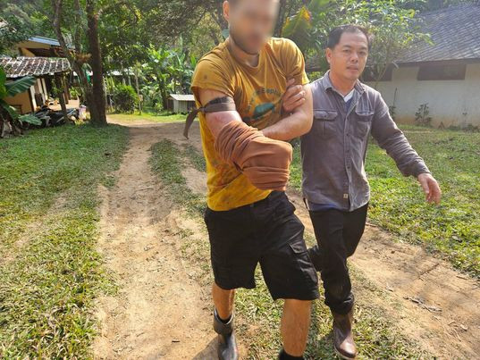 Stefan Specogna với vết thương trên tay sau khi bị gấu đen cắn. (Ảnh: ST) Stefan Specogna với vết thương trên tay sau khi bị gấu đen cắn. (Ảnh: ST)