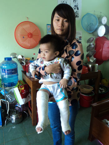 Bé Long mới 12 tháng tuổi - cái tuổi còn đang lẫm chậm tập đi thì đã phải chịu nỗi đau quá lớn này