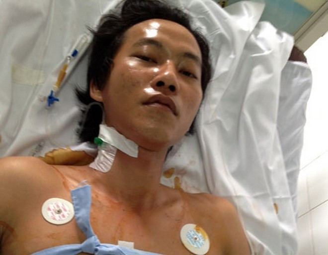 Hung thủ Nguyễn Thanh Luận đang được điều trị tại bệnh viện Hung thủ Nguyễn Thanh Luận đang được điều trị tại bệnh viện Bài viết: http://news.zing.vn/Chan-dung-ke-giet-nguoi-kinh-hoang-trong-quan-ca-phe-post370598.html#home_featured.tinnong Nguồn Zing News