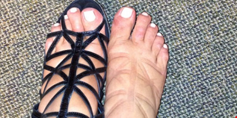 Những trang phục, phụ kiện ngấm ngầm hủy hoại sức khỏe ảnh 3