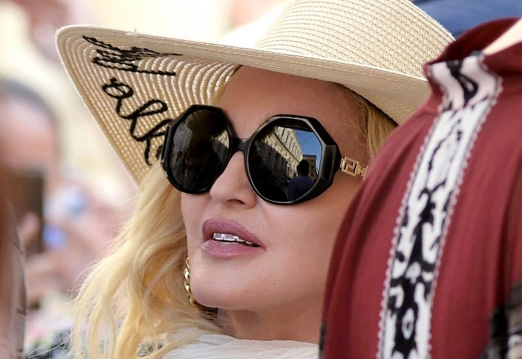 Madonna còn mang cả bọc răng bằng vàng.