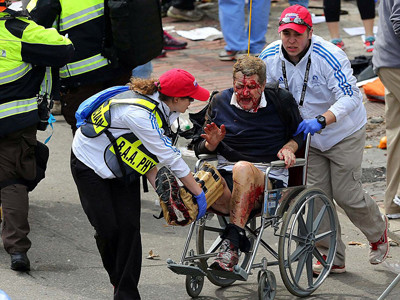 Một nạn nhân của vụ đánh bom thảm khốc tại Boston, Mỹ. Ảnh: AP. Một nạn nhân của vụ đánh bom thảm khốc tại Boston, Mỹ. Ảnh: AP