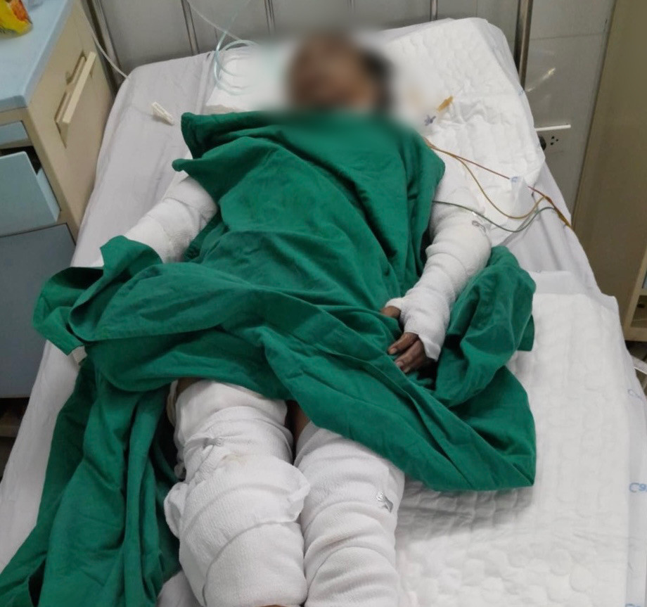 Các nạn nhân đang được các bác sĩ tích cực điều trị