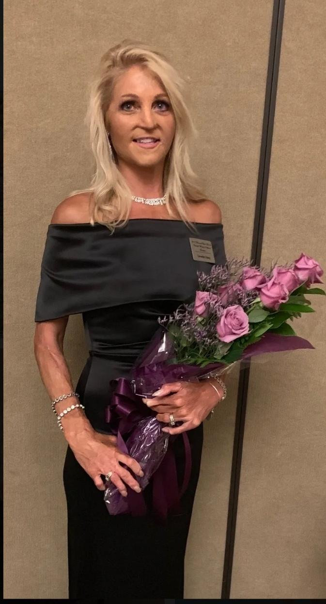 Bên cạnh đó, người phụ nữ này vẫn ước mơ được đi thi hoa hâu, tuy nhiên những vết sẹo chằng chịt và loang lổ trên khắp cơ thể khiến cô cảm thấy tự ti.