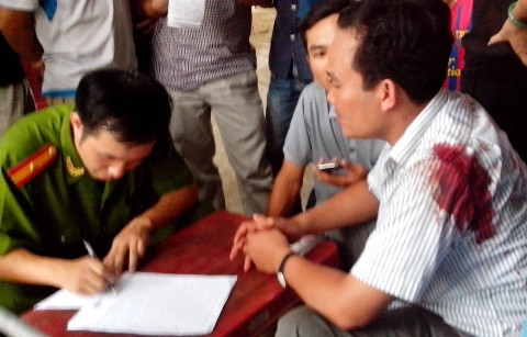 Công an lập biên bản vụ việc - Nạn nhân bị bắn vào tay