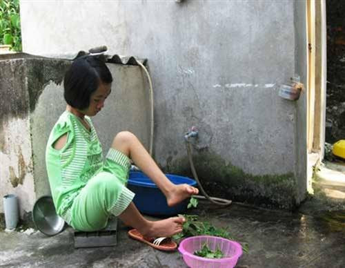 Hãy thắp sáng ước mơ cho cô gái khuyết tật ảnh 2