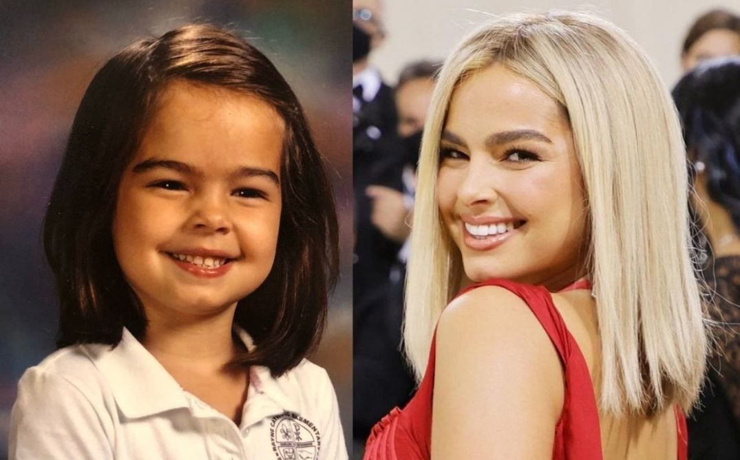 Addison đã học khiêu vũ chuyên nghiệp từ năm 6 tuổi.