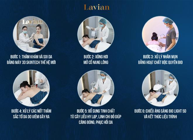 Quy trình thực hiện điều trị viêm da tại Lavian không đau, an toàn hiệu quả cao