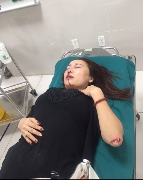 Nữ giám đốc tố cả gia đình liên tục bị nhóm côn đồ truy sát bằng súng ảnh 1