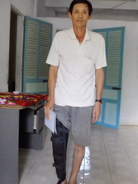 Ông Mum với chân phải bị đánh thương tật. Ảnh: Tuấn Anh