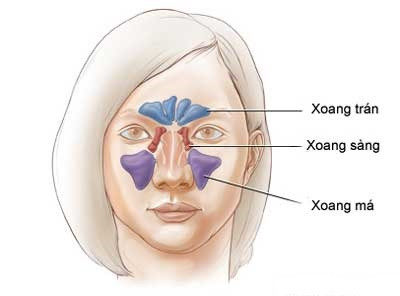 Viêm xoang - Làm gì để trị dứt điểm?