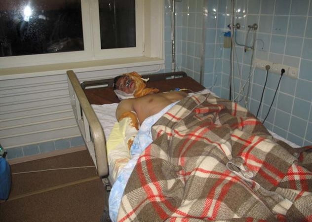 Một nạn nhân bị thương trong vụ cháy nằm ở bệnh viện. Một nạn nhân bị thương trong vụ cháy nằm ở bệnh viện.