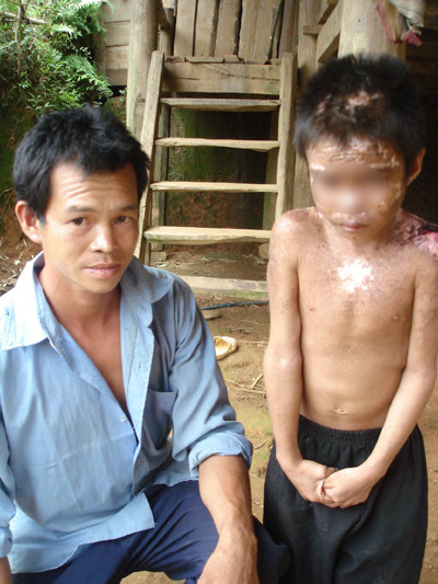 Em Xa Văn Tâm và bố