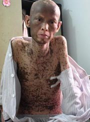 Người đàn ông mang hình hài của... cóc ảnh 2