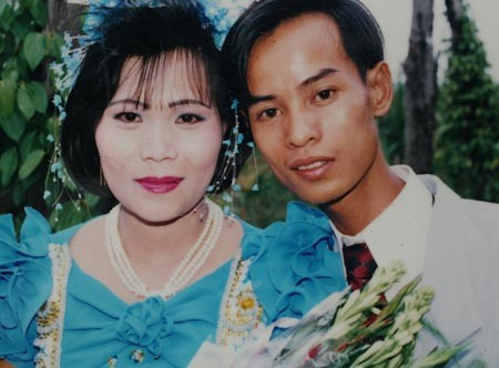 Người đàn ông mang hình hài của... cóc ảnh 3