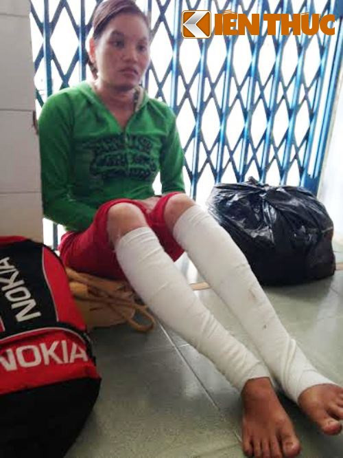 Hai mẹ con bỏng nặng vì bị ném 'bom' xăng ảnh 1