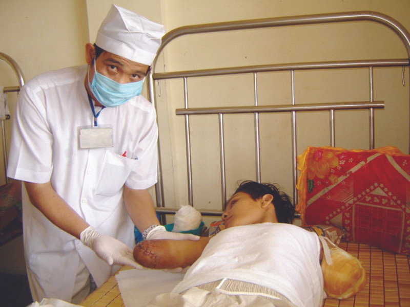 Em Hoàng Em nhập viện vì một tai nạn ở lò gạch