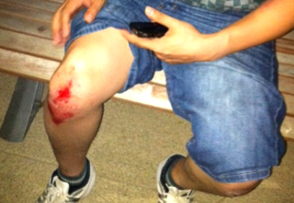 Anh Trần Thanh Hiền bị bảo vệ của tòa nhà đánh vỡ bánh chè